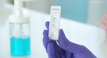 ANMAT: luz verde para un test rápido de coronavirus