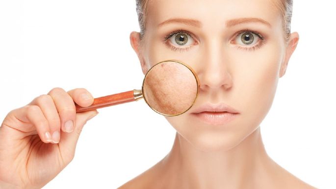 5 remedios naturales para eliminar las manchas de la piel sin químicos