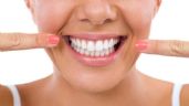 Vinagre: un remedio natural para terminar con el sarro dental y tener una sonrisa perfecta