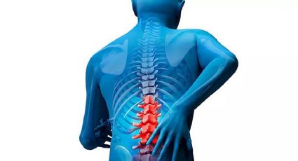 Cuatro maneras de aliviar el dolor de espalda