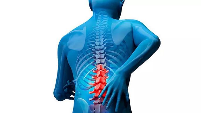 Cuatro maneras de aliviar el dolor de espalda